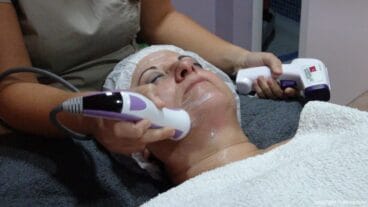 Harmonía – Radiofrecuencia facial