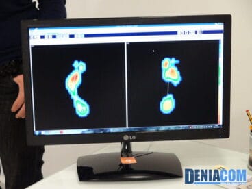 Huella Digitalizada en PodoDénia