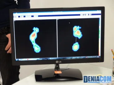 Huella Digitalizada en PodoDénia