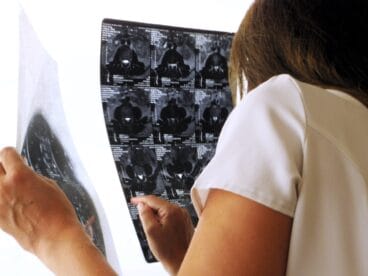 Dénia Quiropráctica, análisis de radiografías