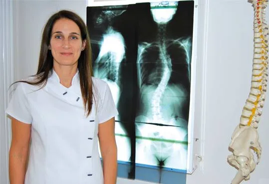 Para solucionar la escoliosis, consulte con su quiropráctico 2 La doctora Virgine Robin trata la Escoliosis