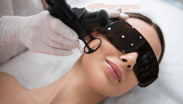 Peeling médico químico para tratar el acné y afinar la textura cutánea