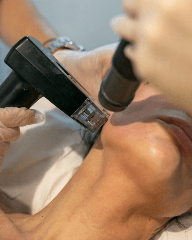 Clínica Estética Castelblanque 9 tratamiento con laser corporal nordlys para el rejuvenecimiento de la piel