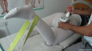 Centre Fisiobioestètic – Tratamiento LPG