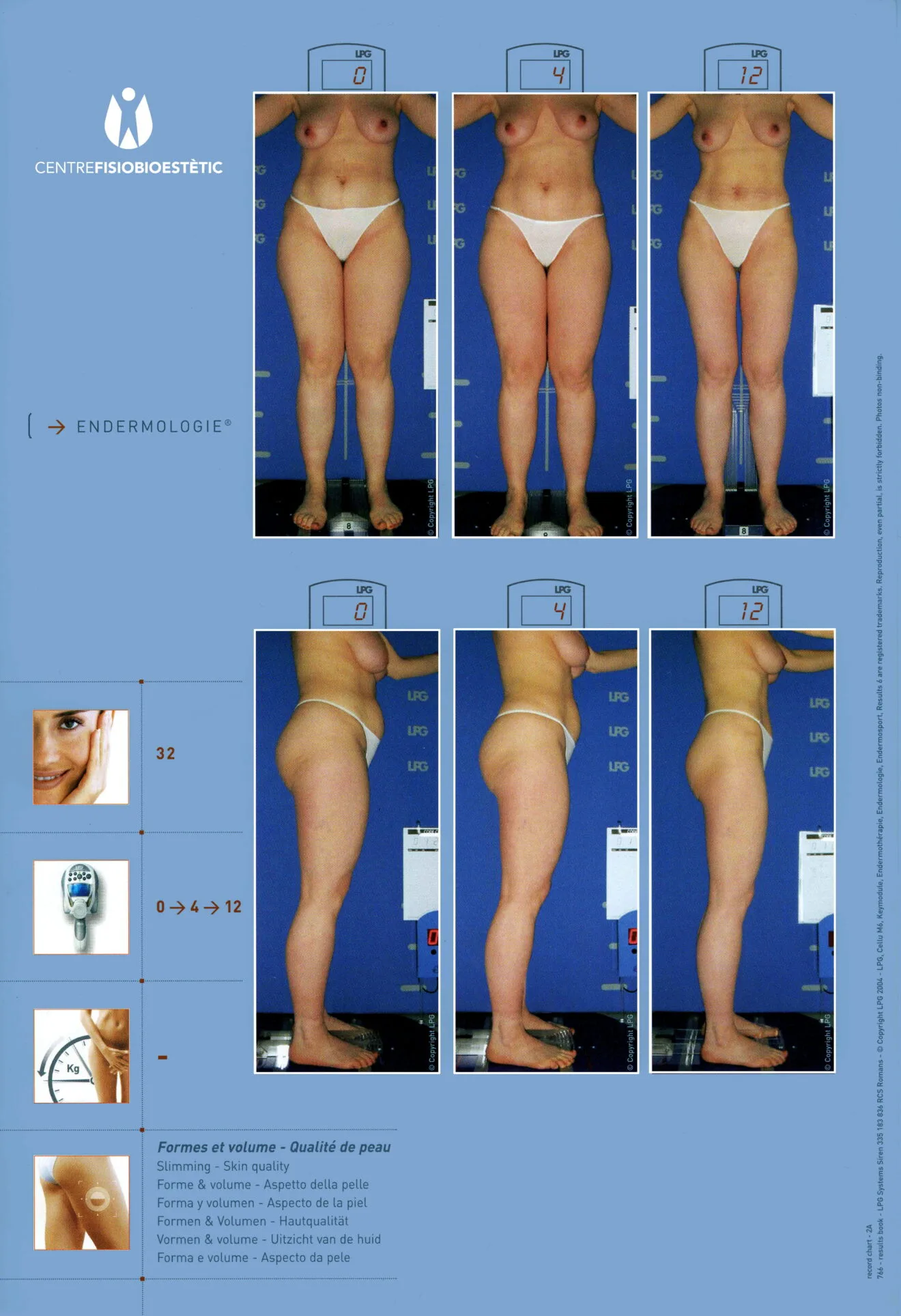 Centre Fisiobioestètic - antes y después