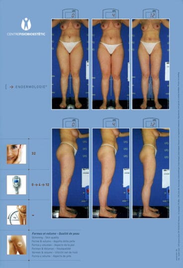 Centre Fisiobioestètic – antes y después