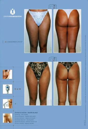 Centre Fisiobioestètic – resultados