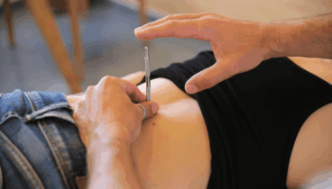 Acupuntura en Dénia – Centre fisiobioestétic