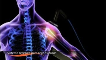 Tratamiento INDIBA activ Dénia