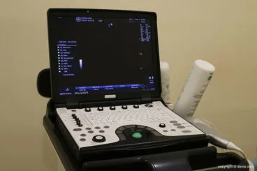 Ecocardiografía en REMA