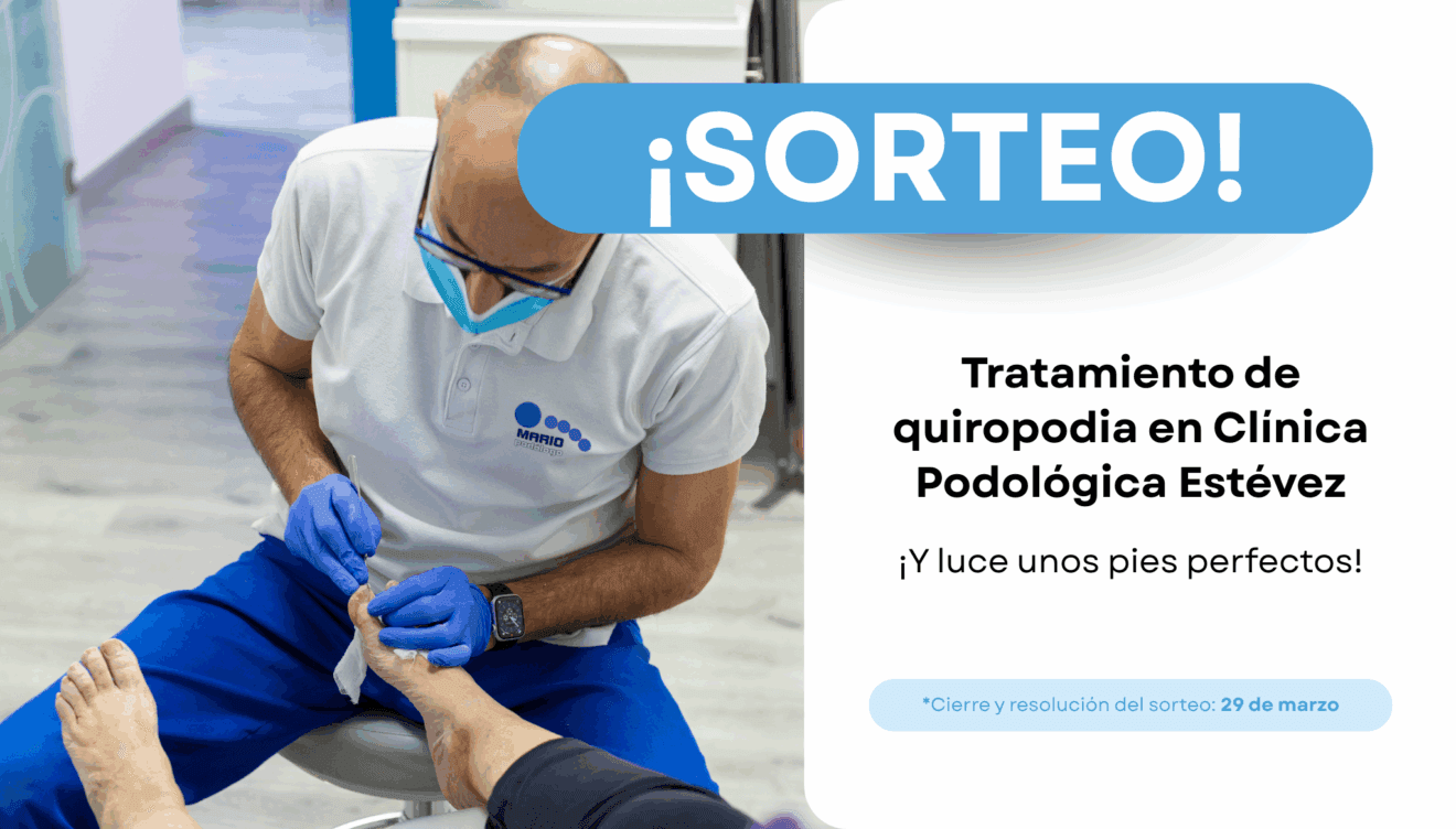 Sorteo Tratamiento de quiropodia en Clínica Podológica Estévez