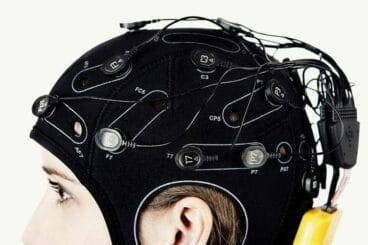 Estimulador cerebral