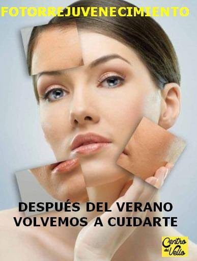 Fotorejuvenecimiento Centro del Vello