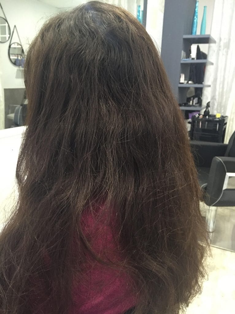 La Mode Antes tratamiento