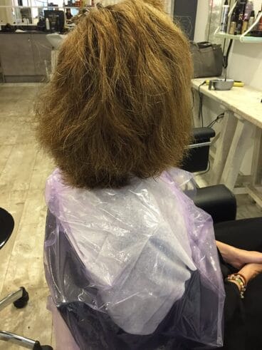 Tratamiento 2 Antes La mode