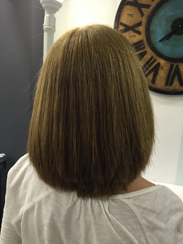 después Taninoplastia