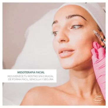 Mesoterapia facial – Clínica Médica Montgó