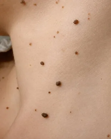 Procedimientos quirúrgicos de estética facial y corporal