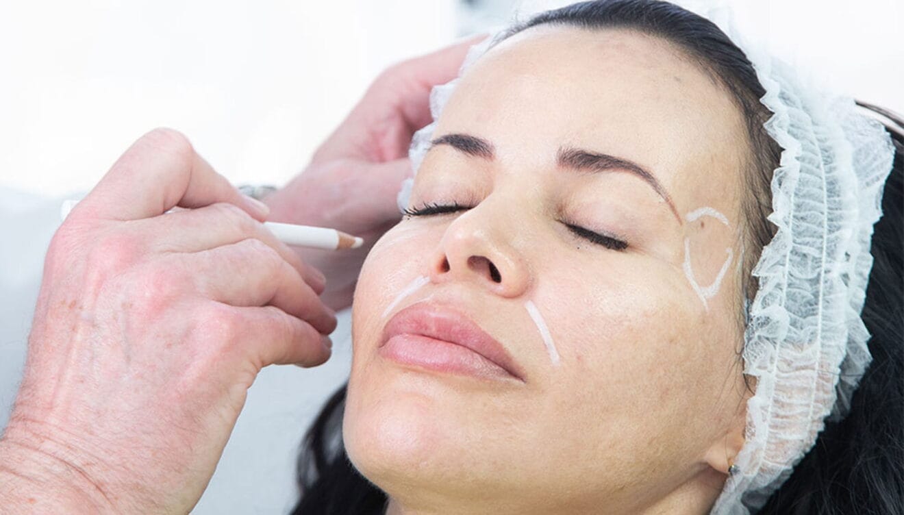 Clínica Médica Montgó sortea un tratamiento bótox