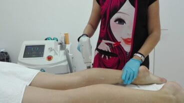 Laser Diodo Piernas Victoria Estetica Bienestar