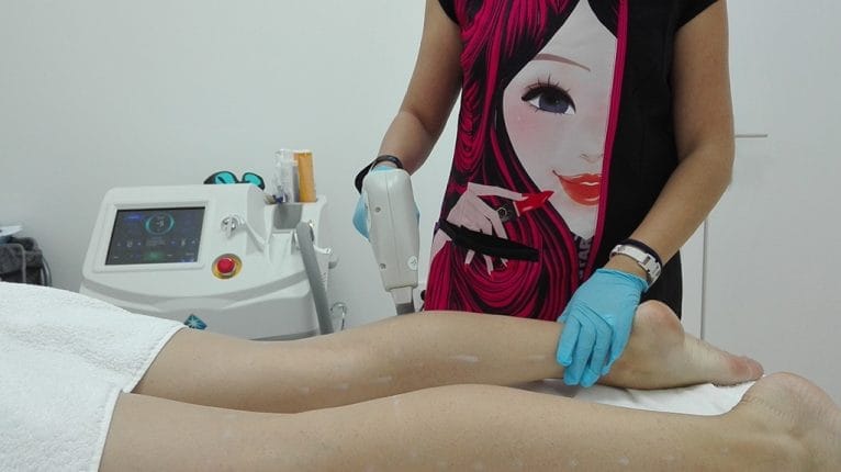 Laser Diodo Piernas Victoria Estetica Bienestar