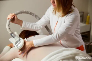 LPG Endermologie – Policlínica Cume
