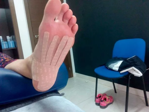 Protection of the plantar fascia Clinic Kins