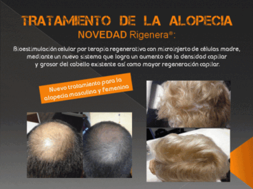 alopecia banner cristal 590x443