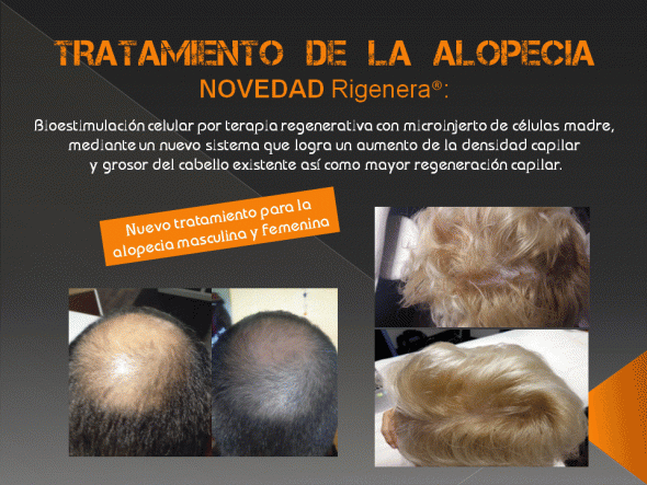 alopecia banner cristal 590x443
