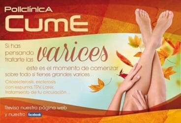 tratamiento de varices policlinica cume
