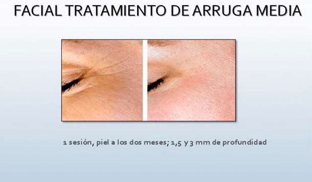 arrugas dorita e inma estilistas