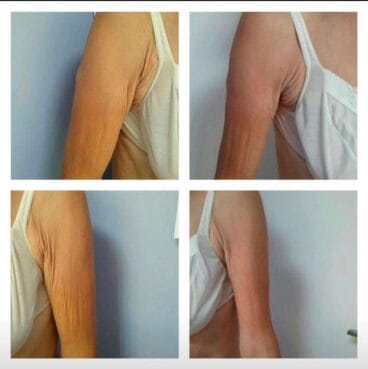 Para brazos Dorita e Inma Estilistas