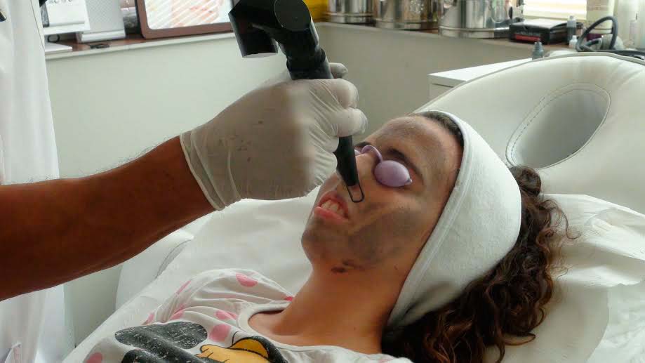 eliminacion de manchas policlinica cume