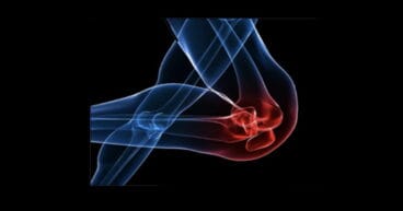 musculo hla san carlos