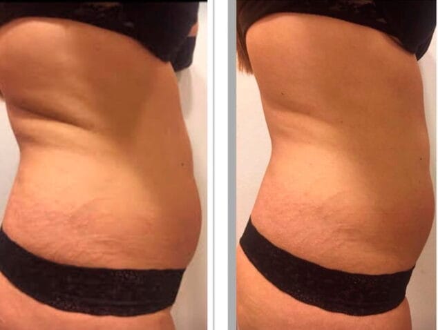 dorso ultrasonix dorita e inma estilistas