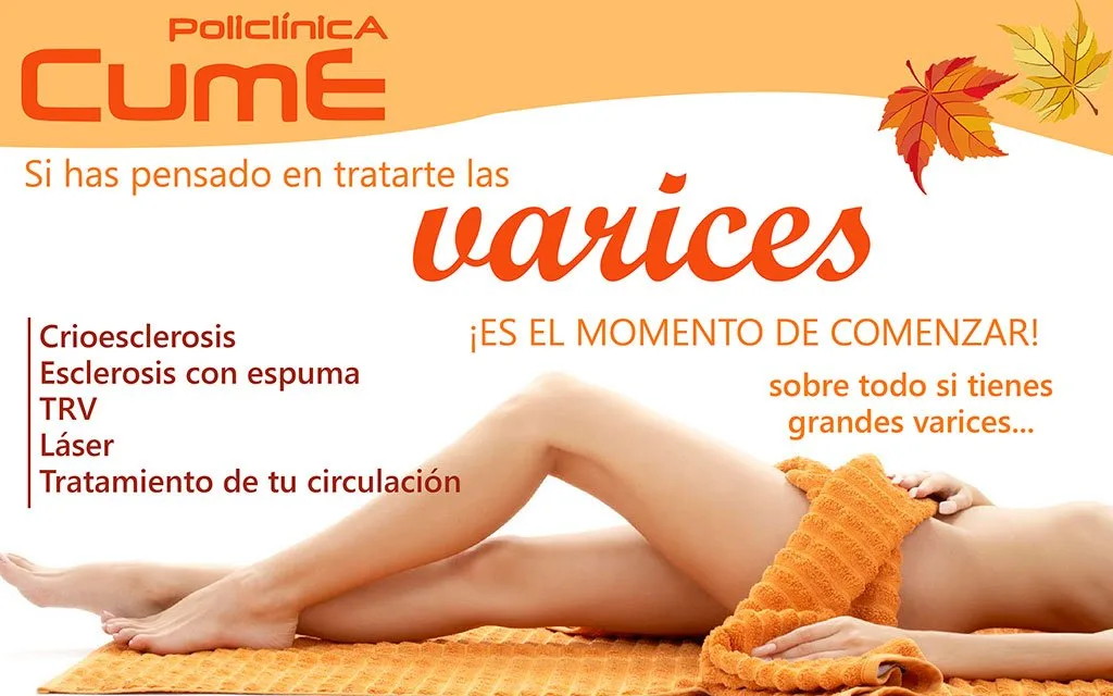 Eliminar varices Policlínica CUME