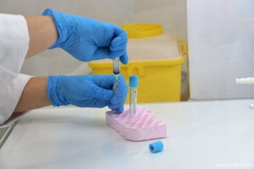Tratamiento PRP en Clínica Doctora Flores de Apodaca