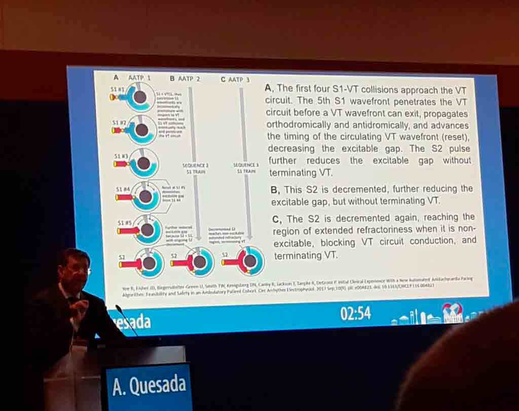 el doctor quesada en congresos de cardiologia en roma clinica glorieta