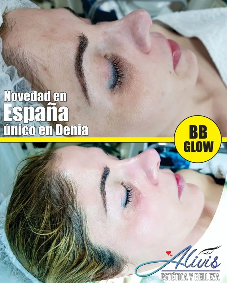 BB Glow Alivis Estética y Belleza