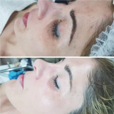 tratamiento belleza en alivis estetica y belleza