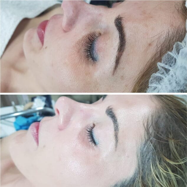 tratamiento belleza en alivis estetica y belleza