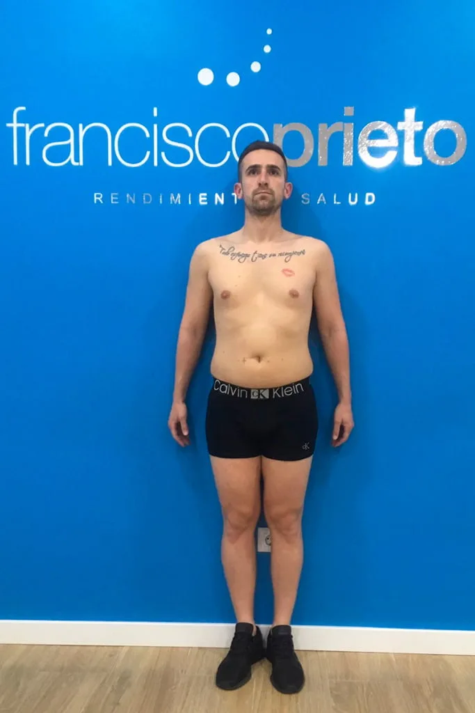 Antes del Cambio Físico Radical - Francisco Prieto Studio