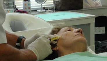 tratamiento antiarrugas en javea policlinica cume