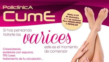tratamiento varices policlinica cume fb2