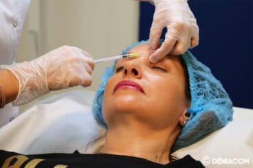 botox en denia clinica estetica castelblanque fb