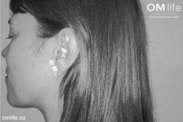 Auriculoterapia en Dénia, una terapia holística con múltiples beneficios – Om Life Dénia