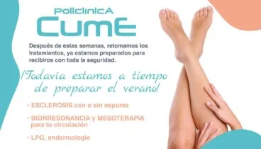 tratamiento varices en javea policlinica cume fb