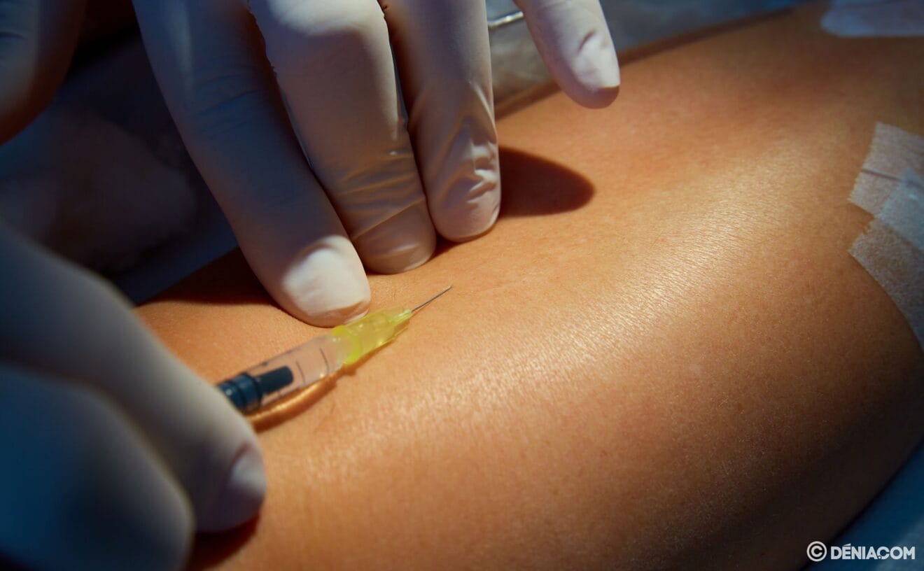 Tratamiento contra las varices - Policlìnica CUME