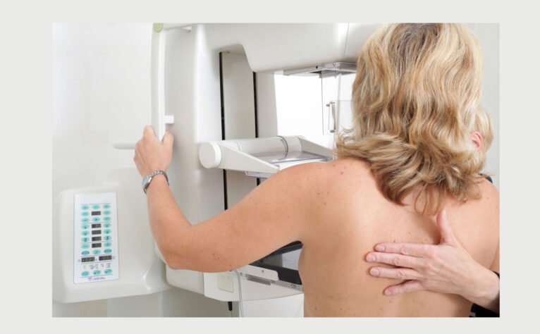 Los hospitales del Grupo HLA cuentan con tecnología más avanzada para el diagnóstico precoz del cáncer de mama - HLA San Carlos