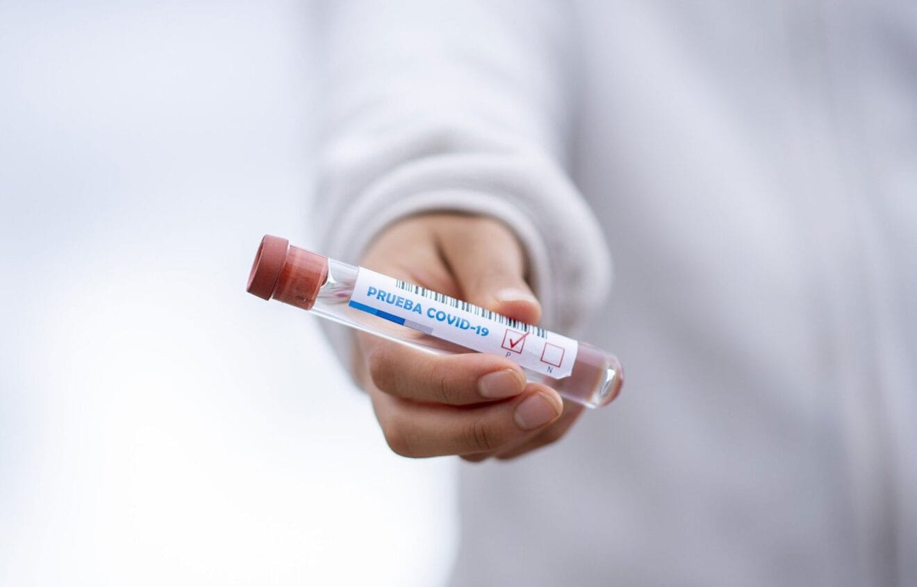 Información útil sobre los tests de coronavirus en Dénia - Laboratorios González